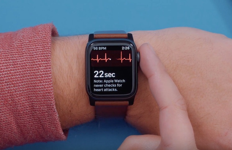 Apple watch ekg feature deals