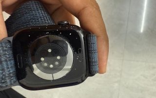 Apple Watch Series 10: Ist bei Euch auch der Lack ab?