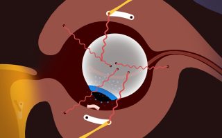 Spieletipp: Bacon in Zane