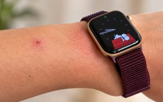 Apple Watch Series 12 und Ultra 4: Schuld an Haut-Irritationen?